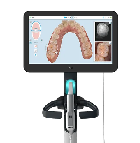 ماسح داخل الفم iTero — صورة تعريفية للمنتج — iTero intraoral scanner — Product image