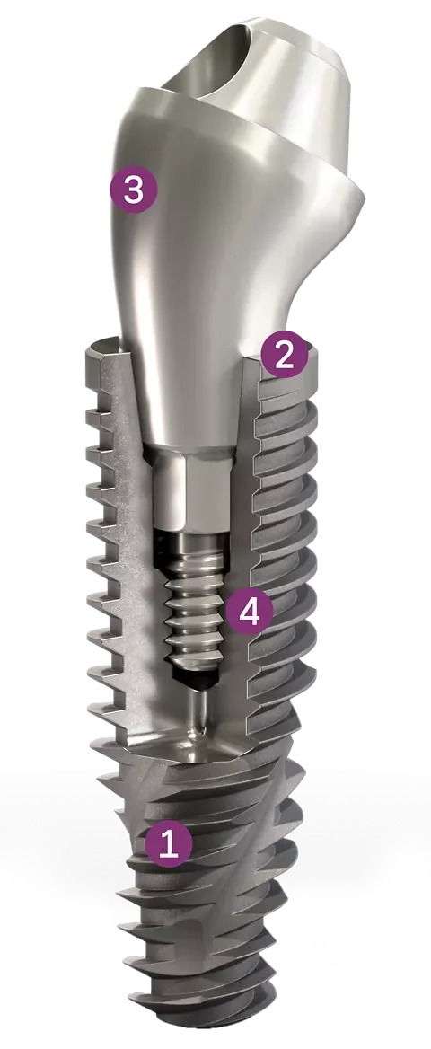 مكوّنات زرعة Neodent — صورة تعريفية — Neodent implant components — product image